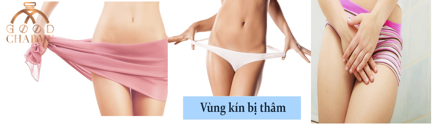 Gel Trị Thâm Vùng Kín Inner Perfume 20ml
